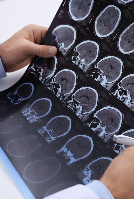 Multiple Sclerosis Treatment